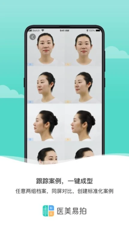 医美易拍app图