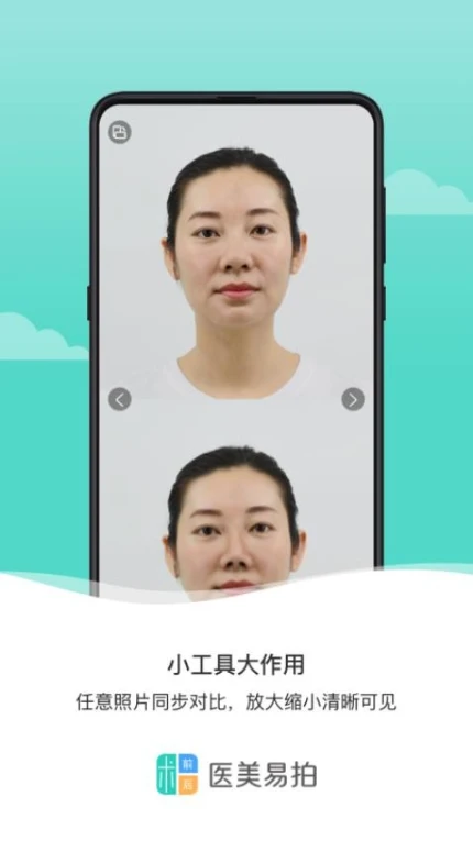 医美易拍app图