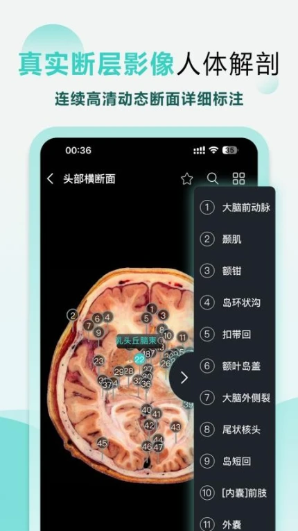 掌上3D解剖免费版图